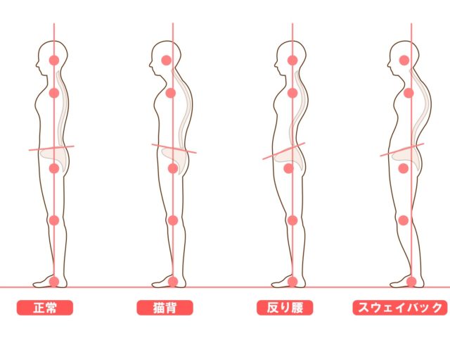 骨格矯正で頭痛を予防！ゼロスポ鍼灸・整骨院【喜多見】の予防法